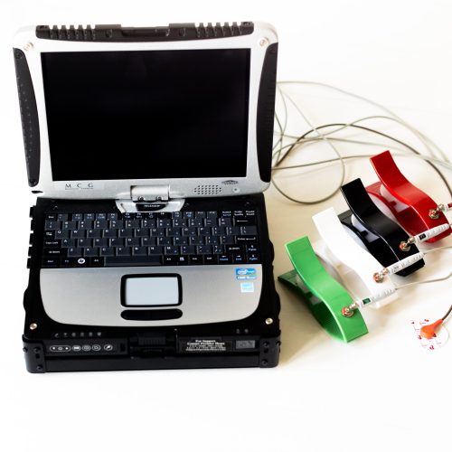 MCG test unit with red, white, black, and red clips and wires connected to the laptop